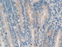 DAB staining on IHC-P; Samples: Rat Intestine Tissue; Primary Ab: 10µg/ml Rabbit Anti-Rat MMP23A Antibody Second Ab: 2µg/mL HRP-Linked Caprine Anti-Rabbit IgG Polyclonal Antibody