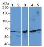 Western Blot; Sample: Lane1: Porcine Cerebrum lysate; Lane2: Porcine Stomach lysate; Lane3: Porcine Skeletal muscle lysate; Lane4: Hela cell lysate; Lane5: HepG2 cell lysate; Primary Ab: 1μg/ml Rabbit Anti-Human PK Antibody; Second Ab: 0.2µg/mL HRP-Linked Caprine Anti-Rabbit IgG Polyclonal Antibody;