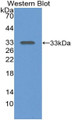 Western Blot; Sample: Recombinant protein.