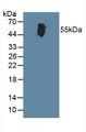 Western Blot; Sample: Human Blood Cells.