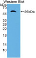 Western Blot; Sample: Recombinant protein.