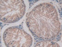 DAB staining on fromalin fixed paraffin- embedded stomach tissue)