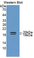 Western Blot; Sample: Recombinant protein.