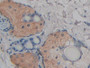 DAB staining on IHC-P; Samples: Rat Skin Tissue; Primary Ab: 10µg/ml Rabbit Anti-Rat FABP9 Antibody Second Ab: 2µg/mL HRP-Linked Caprine Anti-Rabbit IgG Polyclonal Antibody