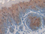 DAB staining on IHC-P; Samples: Mouse Esophagus Tissue; Primary Ab: 30µg/ml Rabbit Anti-Mouse FABP9 Antibody Second Ab: 2µg/mL HRP-Linked Caprine Anti-Rabbit IgG Polyclonal Antibody