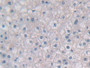 DAB staining on fromalin fixed paraffin-embedded Brain tissue)