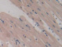 DAB staining on IHC-P; Samples: Rat Heart Tissue; Primary Ab: 20µg/ml Rabbit Anti-Rat GP9 Antibody Second Ab: 2µg/mL HRP-Linked Caprine Anti-Rabbit IgG Polyclonal Antibody