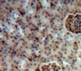 Used in DAB staining on fromalin fixed paraffin-embedded Kidney tissue