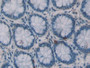 DAB staining on IHC-P; Samples: Human Rectum Tissue; Primary Ab: 20µg/ml Rabbit Anti-Human ELA2 Antibody Second Ab: 2µg/mL HRP-Linked Caprine Anti-Rabbit IgG Polyclonal Antibody