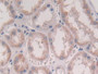 DAB staining on IHC-P; Samples: Human Kidney Tissue; Primary Ab: 30µg/ml Rabbit Anti-Human IFNa2 Antibody Second Ab: 2µg/mL HRP-Linked Caprine Anti-Rabbit IgG Polyclonal Antibody
