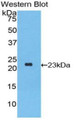 Western Blot; Sample: Recombinant protein.