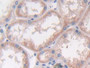 DAB staining on fromalin fixed paraffin-embedded Liver tissue)