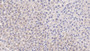 DAB staining on IHC-P; Samples: Rat Liver Tissue;  Primary Ab: 20µg/ml Rabbit Anti-Rat GaA Antibody Second Ab: 2µg/mL HRP-Linked Caprine Anti-Rabbit IgG Polyclonal Antibody 