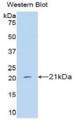 Western Blot; Sample: Recombinant protein.