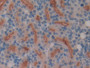 DAB staining on IHC-P; Samples: Rat Kidney Tissue; Primary Ab: 10µg/ml Rabbit Anti-Rat MEP1b Antibody Second Ab: 2µg/mL HRP-Linked Caprine Anti-Rabbit IgG Polyclonal Antibody