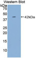 Western Blot; Sample: Recombinant protein.