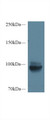 Western Blot; Sample: Mouse Kidney lysate; Primary Ab: 1µg/ml Rabbit Anti-Mouse MEP1a Antibody Second Ab: 0.2µg/mL HRP-Linked Caprine Anti-Rabbit IgG Polyclonal Antibody