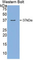 Western Blot; Sample: Recombinant MEP1a, Human.