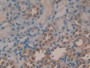 DAB staining on IHC-P; Samples: Human Kidney Tissue; Primary Ab: 20µg/ml Rabbit Anti-Human PGA Antibody Second Ab: 2µg/mL HRP-Linked Caprine Anti-Rabbit IgG Polyclonal Antibody