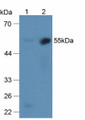 Western Blot; Sample: Lane1: Mouse Liver Tissue; Lane2: Mouse Kidney Tissue.