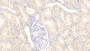 DAB staining on fromalin fixed paraffin-embedded Liver tissue)