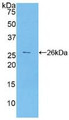 Western Blot; Sample: Recombinant CA125, Human.