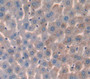 Prostate Specific Antigen (Psa) Polyclonal Antibody, Cat#CAU28446