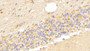 DAB staining on IHC-P; Samples: Human Cerebellum Tissue; Primary Ab: 20μg/ml Rabbit Anti-Human VEGFD Antibody Second Ab: 2µg/mL HRP-Linked Caprine Anti-Rabbit IgG Polyclonal Antibody