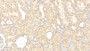 DAB staining on IHC-P; Samples: Human Kidney Tissue; Primary Ab: 20μg/ml Rabbit Anti-Human VEGFD Antibody Second Ab: 2µg/mL HRP-Linked Caprine Anti-Rabbit IgG Polyclonal Antibody