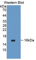 Western Blot; Sample: Recombinant protein.