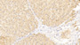 DAB staining on IHC-P; Samples: Human Liver Tissue; Primary Ab: 20μg/ml Rabbit Anti-Human VEGFB Antibody Second Ab: 2µg/mL HRP-Linked Caprine Anti-Rabbit IgG Polyclonal Antibody