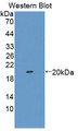 Western Blot; Sample: Recombinant protein.