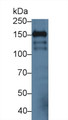 Western Blot; Sample: Mouse Cerebrum lysate; Primary Ab: 3µg/ml Rabbit Anti-Mouse ICAM5 Antibody Second Ab: 0.2µg/mL HRP-Linked Caprine Anti-Rabbit IgG Polyclonal Antibody