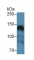 Western Blot; Sample: Mouse Cerebrum lysate; ;Primary Ab: 1µg/ml Rabbit Anti-Human ICAM5 Antibody;Second Ab: 0.2µg/mL HRP-Linked Caprine Anti-Rabbit IgG Polyclonal Antibody;