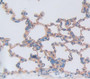 Used in DAB staining on fromalin fixed paraffin- embedded Kidney tissue