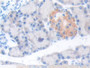 DAB staining on fromalin fixed paraffin-embedded Liver tissue)