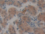 DAB staining on IHC-P; Samples: Human Stomach Tissue;  Primary Ab: 10µg/ml Rabbit Anti-Human TPO Ant