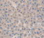 Tumor Necrosis Factor Beta (Tnfb) Polyclonal Antibody, Cat#CAU28492