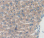 Tumor Necrosis Factor Beta (Tnfb) Polyclonal Antibody, Cat#CAU28494