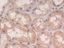 DAB staining on IHC-P; Samples: Human Kidney Tissue; Primary Ab: 30µg/ml Rabbit Anti-Human TNFb Antibody Second Ab: 2µg/mL HRP-Linked Caprine Anti-Rabbit IgG Polyclonal Antibody