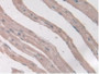 DAB staining on IHC-P; Samples: Rat Heart Tissue.