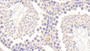 DAB staining on IHC-P; Samples: Mouse Testis Tissue; Primary Ab: 20μg/ml Rabbit Anti-Mouse TIMP2 Antibody Second Ab: 2µg/mL HRP-Linked Caprine Anti-Rabbit IgG Polyclonal Antibody