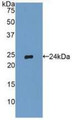 Western Blot; Sample: Recombinant TIMP2, Human.