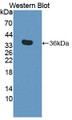 Western Blot; Sample: Recombinant protein.