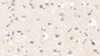 DAB staining on IHC-P; Samples: Human Cerebrum Tissue; Primary Ab: 20μg/ml Rabbit Anti-Human Tie1 Antibody Second Ab: 2µg/mL HRP-Linked Caprine Anti-Rabbit IgG Polyclonal Antibody