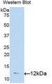 Western Blot; Sample: Recombinant protein.