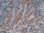 DAB staining on IHC-P; Samples: Human Stomach Tissue; Primary Ab: 20µg/ml Rabbit Anti-Human SDF1 Antibody Second Ab: 2µg/mL HRP-Linked Caprine Anti-Rabbit IgG Polyclonal Antibody