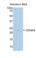 Western Blot; Sample: Recombinant protein.