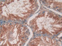 DAB staining on IHC-P; Samples: Rat Testis Tissue; Primary Ab: 20µg/ml Rabbit Anti-Rat CD40L Antibody Second Ab: 2µg/mL HRP-Linked Caprine Anti-Rabbit IgG Polyclonal Antibody