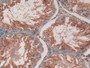 DAB staining on IHC-P; Samples: Rat Testis Tissue)